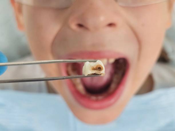 Best Emergency Care for Gum Disease in Wrightwood, CA